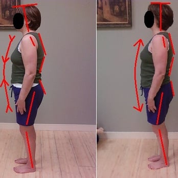 Transformative Bodywork - Before and after one session - Massage Therapy Near Me - Santa Barbara, California Transformative Bodywork - Before and after one session - Massage Therapy Near Me - Santa Barbara, California