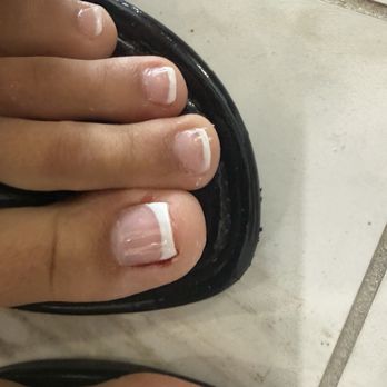 Noire The Nail Bar - bleeding from her picking at them - Nail Salons Near Me - St. Pete Beach, Florida Noire The Nail Bar - bleeding from her picking at them - Nail Salons Near Me - St. Pete Beach, Florida