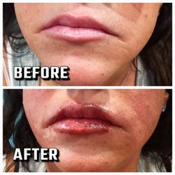 Hydration Plus Beauty