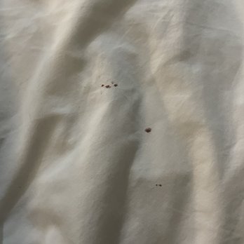 Best Western Plus Ruston Hotel - Blood on sheets - Hotels Near Me - Ruston, Louisiana Best Western Plus Ruston Hotel - Blood on sheets - Hotels Near Me - Ruston, Louisiana