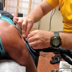 Michael A Selvitella, DC - Attaching the clamps for the electrical acupuncture