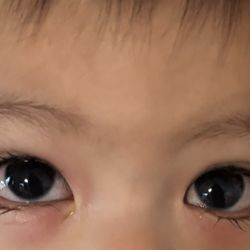 America's Best Contacts & Eyeglasses - Baby pink eye