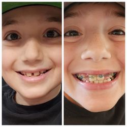 E-orthodontics