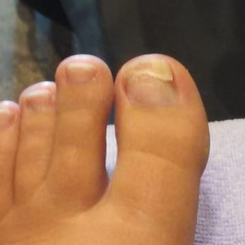 Sassy Nails and Spa - They ripped my nail apart! Worst place ever!! - Nail Salons Near Me - Meridian, Idaho Sassy Nails and Spa - They ripped my nail apart! Worst place ever!! - Nail Salons Near Me - Meridian, Idaho