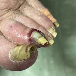 Consulate Health Care at West Altamonte - These are Mom's feet.