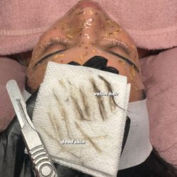 What comes off of your skin during a dermaplane