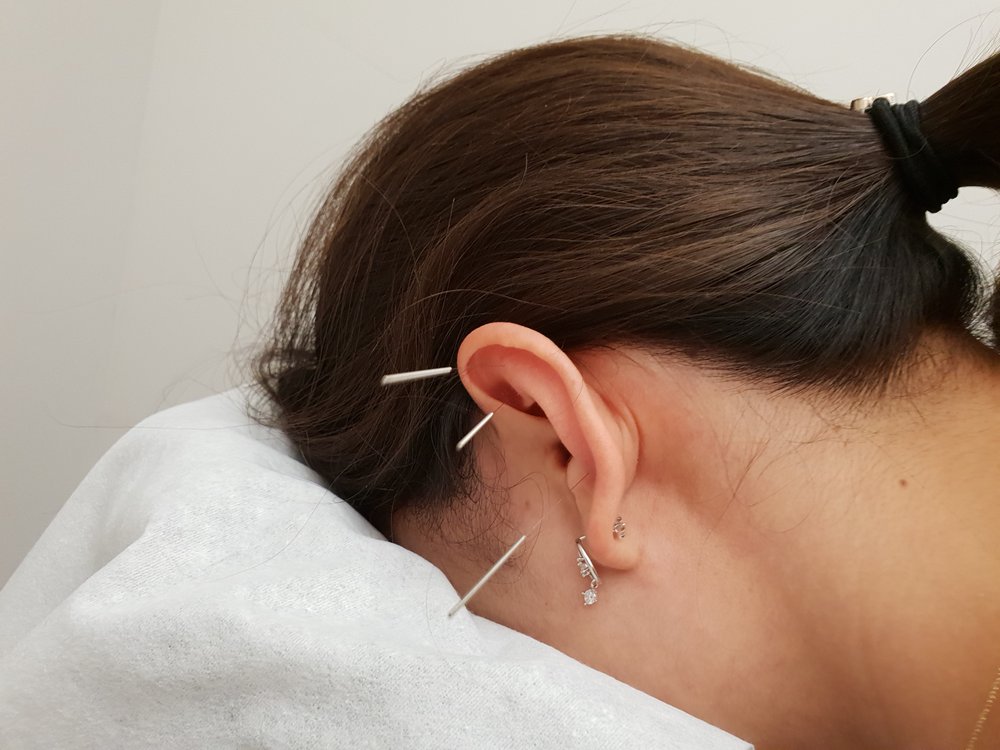 ACUPUNCTURE CENTER CHICAGO Updated July 2024 10 Photos 17 N Wabash Ave, Chicago, Illinois