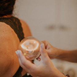 Natalia Morrison - Acupuncture & Holistic Medicine - Cupping is a treatment that addresses the health and functionality of the muscles and fascia. It helps promote lymph detox, circulation