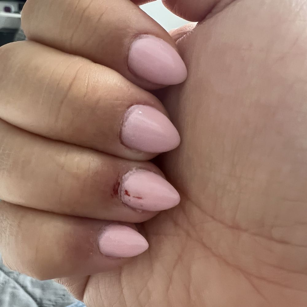 Cut bleeding for the aggressive filing