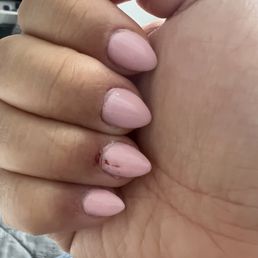Cut bleeding for the aggressive filing