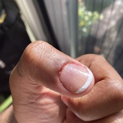 Sky Nail Spa - Horrible, blood, INFECTION PERIOD