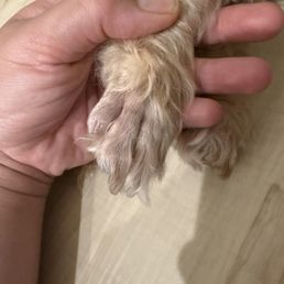 her healed toe and nail just 10 days later! Thank you Dr. Hwang! her healed toe and nail just 10 days later! Thank you Dr. Hwang!