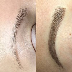 TK Beauté - Before and After