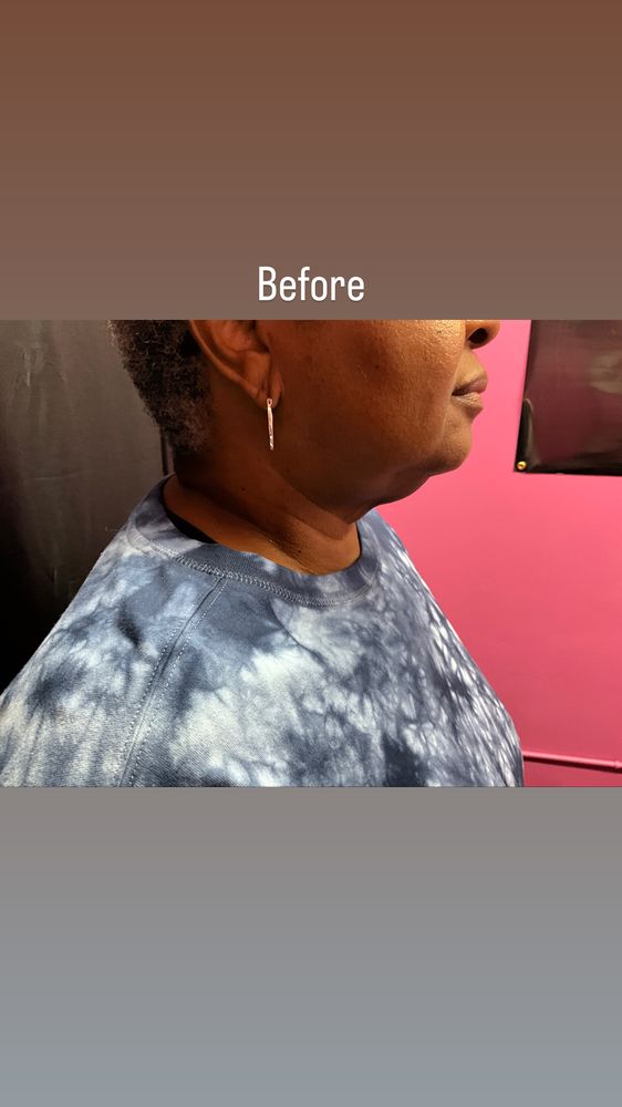 LASCULPT BODYSCULPTING SPA Updated September 2024 10 Photos 2543