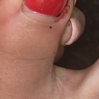 Swan Nails & Spa - Cut in skin. - Nail Salons Near Me - San Marcos, California Swan Nails & Spa - Cut in skin. - Nail Salons Near Me - San Marcos, California