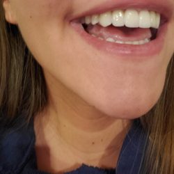 Pamela Marzban - Dr. Sirlanli's work