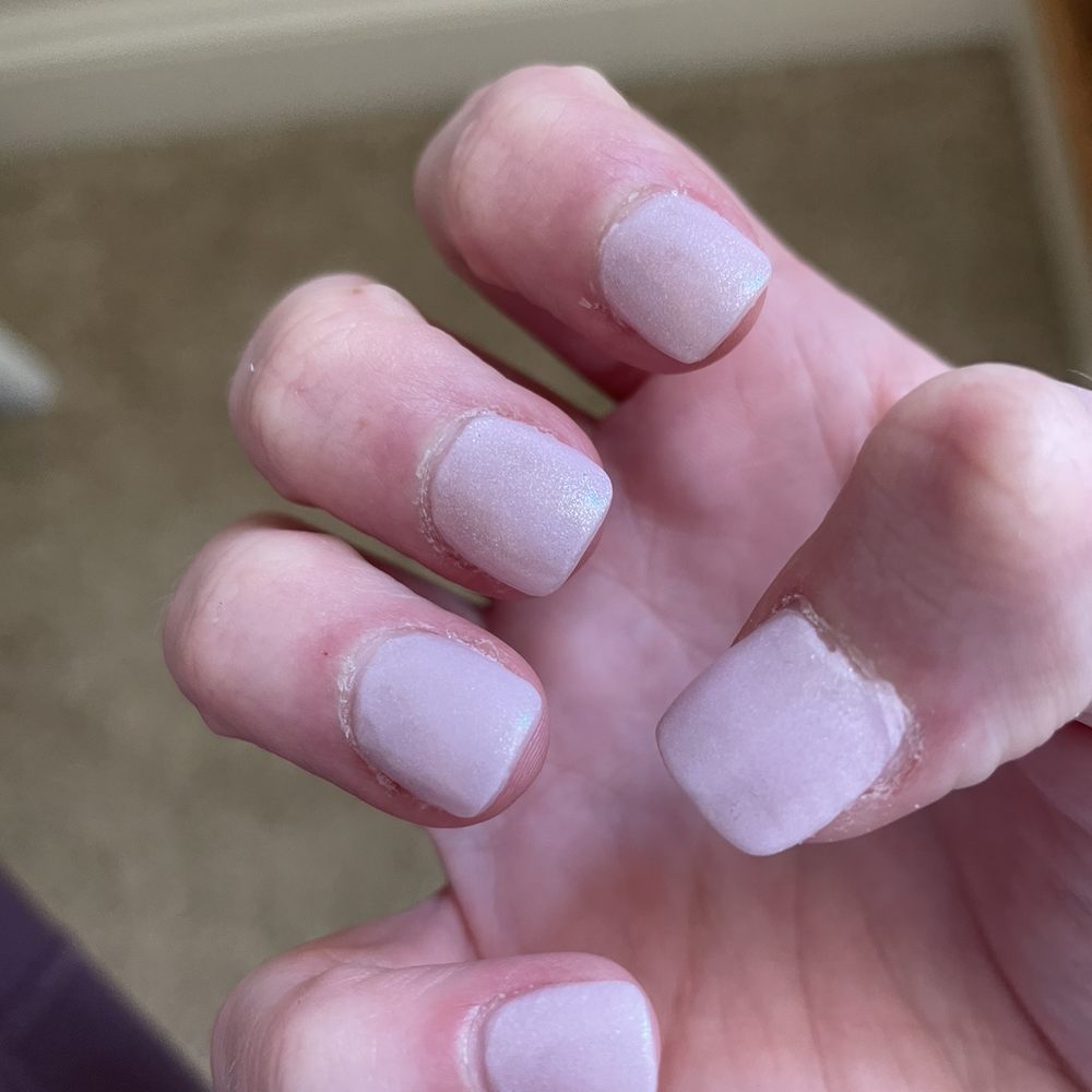 Party Nails And Spa - Untrimmed cuticles, badly done acrylic, and boxy shape. - Nail Salons Near Me - Monroe, North Carolina