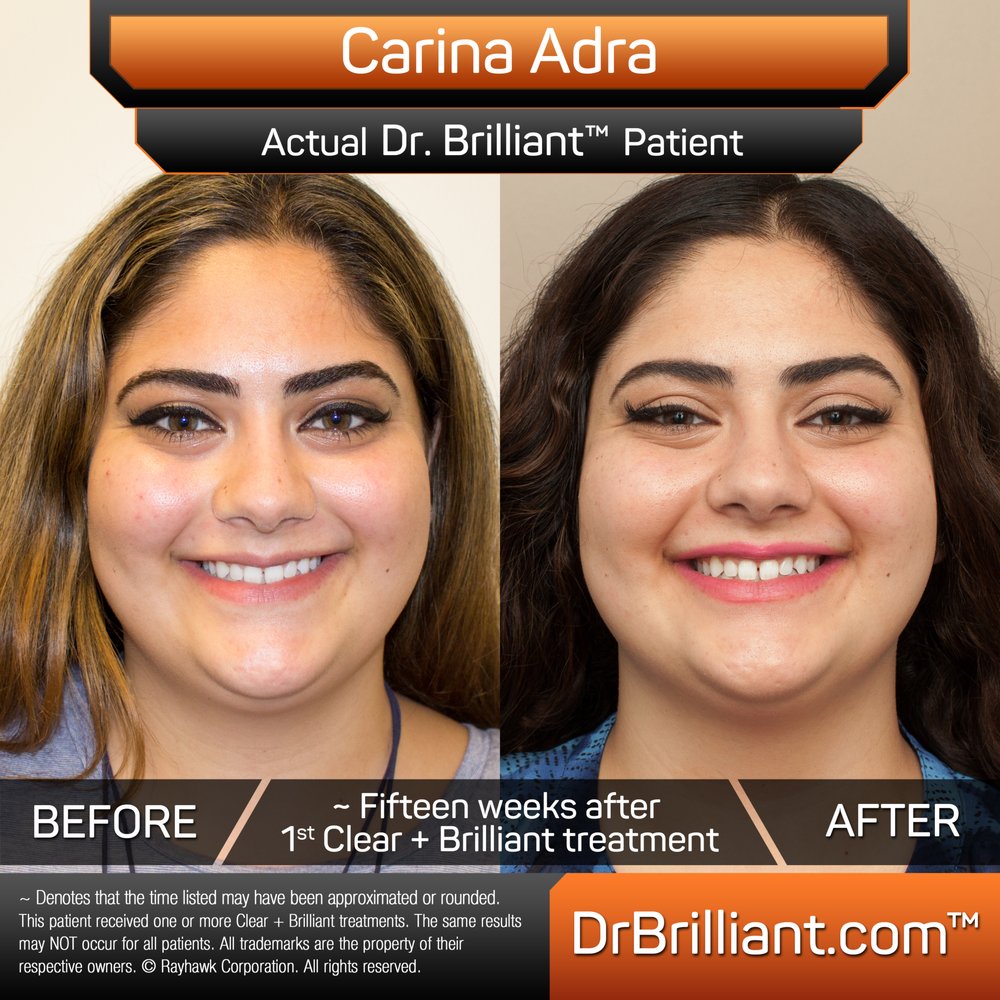 Dr. Brilliant Logo