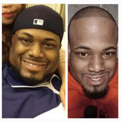 Michael Feiz, MD - The picture on the right is a whole new me.