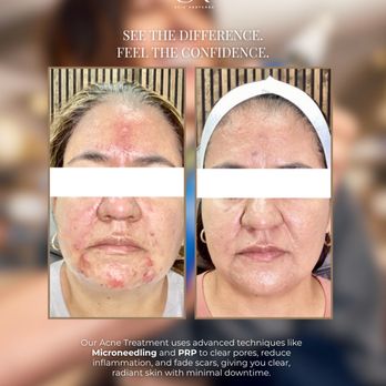 Skin Restored - Medical Spas Near Me - Fresno, California Skin Restored - Medical Spas Near Me - Fresno, California