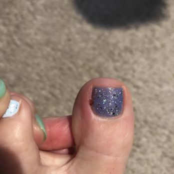 Platinum Nails - On the left side of my big toe, it's red, cut and swollen. You really suck, Platinum. - Nail Salons Near Me - Walnut Creek, California Platinum Nails - On the left side of my big toe, it's red, cut and swollen. You really suck, Platinum. - Nail Salons Near Me - Walnut Creek, California