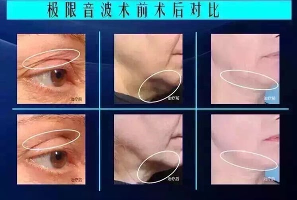 U2 Beauty Spa by null