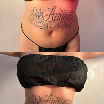 Body Babes - Body Contouring Near Me - Pico Rivera, California