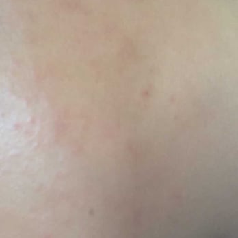 Zhong Huang Spa - The doctor said his face was infected - Day Spas Near Me - Flushing, New York Zhong Huang Spa - The doctor said his face was infected - Day Spas Near Me - Flushing, New York