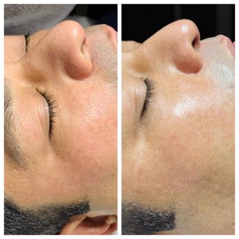 REJUVIE SKINCARE - Updated September 2025 - 10 Photos - 425