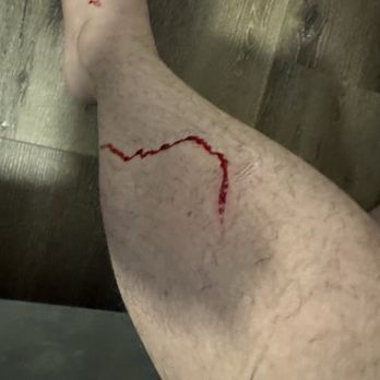 Kustom Disaster Restoration - Rusty sink cut my leg open - General Contractors Near Me - Gold River, California Kustom Disaster Restoration - Rusty sink cut my leg open - General Contractors Near Me - Gold River, California