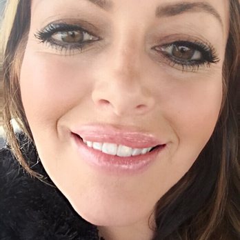Velvet Effect Lasers - My Smiling lips after augmentation by Marietta at Velvet Effect Lasers (Feb2019)they're a little chapped, that's from winter. - Laser Hair Removal Near Me - Rego Park, New York Velvet Effect Lasers - My Smiling lips after augmentation by Marietta at Velvet Effect Lasers (Feb2019)they're a little chapped, that's from winter. - Laser Hair Removal Near Me - Rego Park, New York