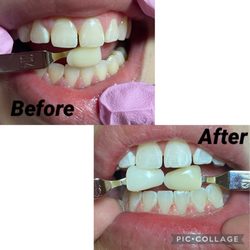 Beauty At Its Finest - Before and after results