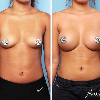 Finesse Plastic Surgery - Medical Spas Near Me - Orange, California