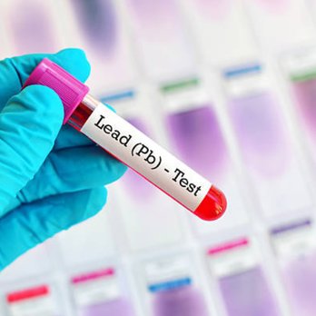 Indoor Clean Air Testing - Lead Testing - Environmental Testing Near Me - Mission Viejo, California Indoor Clean Air Testing - Lead Testing - Environmental Testing Near Me - Mission Viejo, California