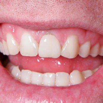 Royal Orthodontics - Orthodontists Near Me - New York, New York Royal Orthodontics - Orthodontists Near Me - New York, New York