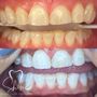 Photo of Shine Laser Teeth Whitening Spa