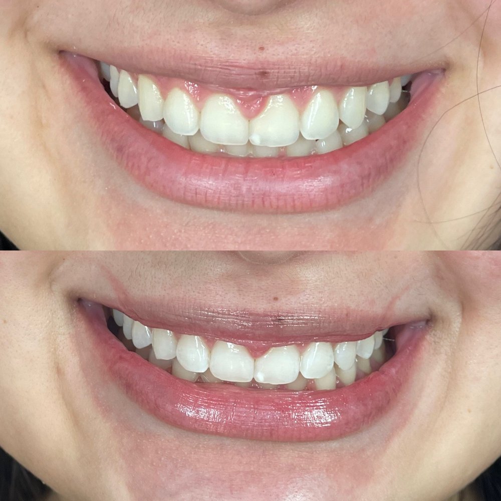 COSMETICSBY_PAIGE 1212 Nth 10th Ave, Hanford, California Teeth