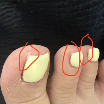 Tip And Toe Paradise - Uneven polish - Nail Salons Near Me - Maple Valley, Washington Tip And Toe Paradise - Uneven polish - Nail Salons Near Me - Maple Valley, Washington