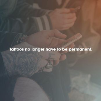Removery Tattoo Removal & Fading - Tattoo Removal Near Me - Arlington, Virginia Removery Tattoo Removal & Fading - Tattoo Removal Near Me - Arlington, Virginia