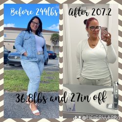 Inspire Weight Loss - Davie - Weightloss Comparison