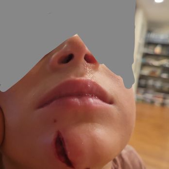 Soheil Simzar, MD - Big cut! - Dermatologists Near Me - Santa Monica, California Soheil Simzar, MD - Big cut! - Dermatologists Near Me - Santa Monica, California