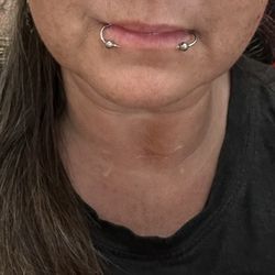 Lips