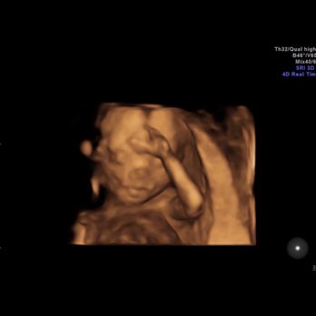 First Look Ultrasound Nola - Ultrasound Imaging Centers Near Me - Kenner, Louisiana First Look Ultrasound Nola - Ultrasound Imaging Centers Near Me - Kenner, Louisiana