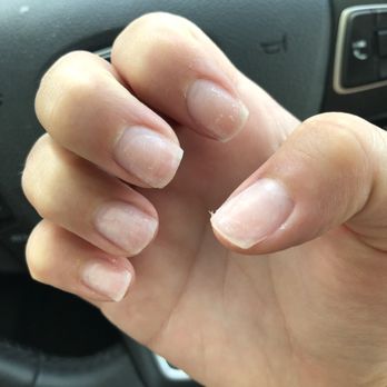 Oasis Nails - My nails after I got my acrylics taken off... zoom in to see how jagged they are - Nail Salons Near Me - Livonia, Michigan
