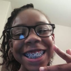 Braces Braces - Cheese