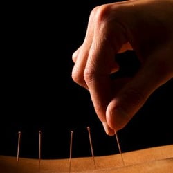 Georjana Grace Shames, LAc, NHD - Acupuncture = Awakening The Body's Intelligence To Heal Itself