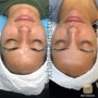 Photo of Exhale Skin Studio