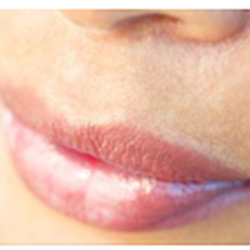 Laser & Skin Care Co