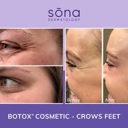 Sona MedSpa