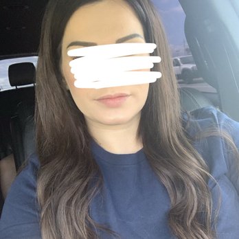 Ideal Image North Austin - Lip fillers - Laser Hair Removal Near Me - Austin, Texas